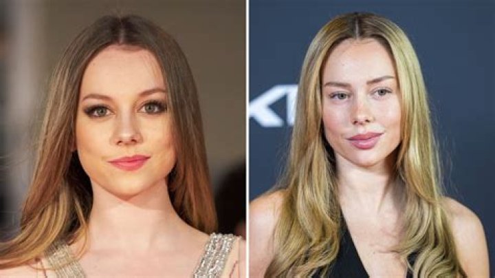Ester Expósito Plastic Surgery: Before And After, Age Boyfriend And Net Worth