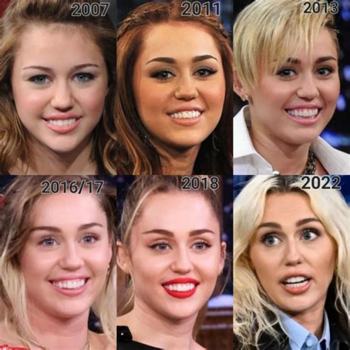 Fact Check: Has Adele Had Her Teeth Done?
