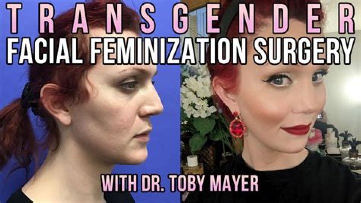 Man Or Woman: Is Zion Moreno Transgender? Before And After Surgery Pictures