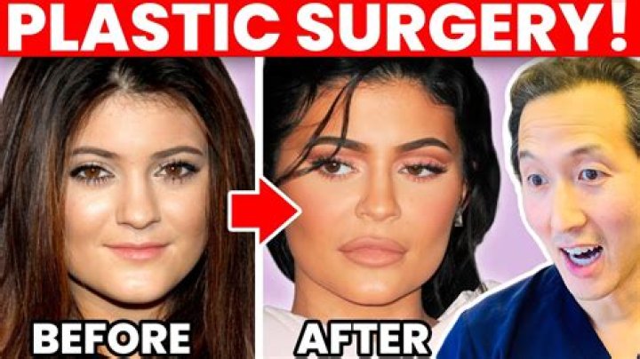 Pat Sajak Weight Loss Journey: Plastic Surgery Before And After
