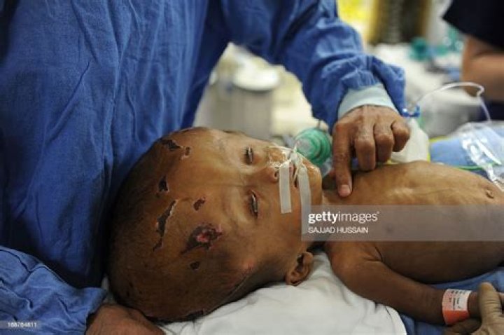 Roona Begum Wikipedia: Baby Roona Death: How Did She Die?